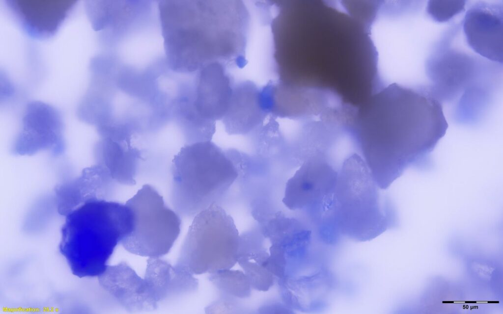 Lapis lazuli close-up chemistry dental caclulus