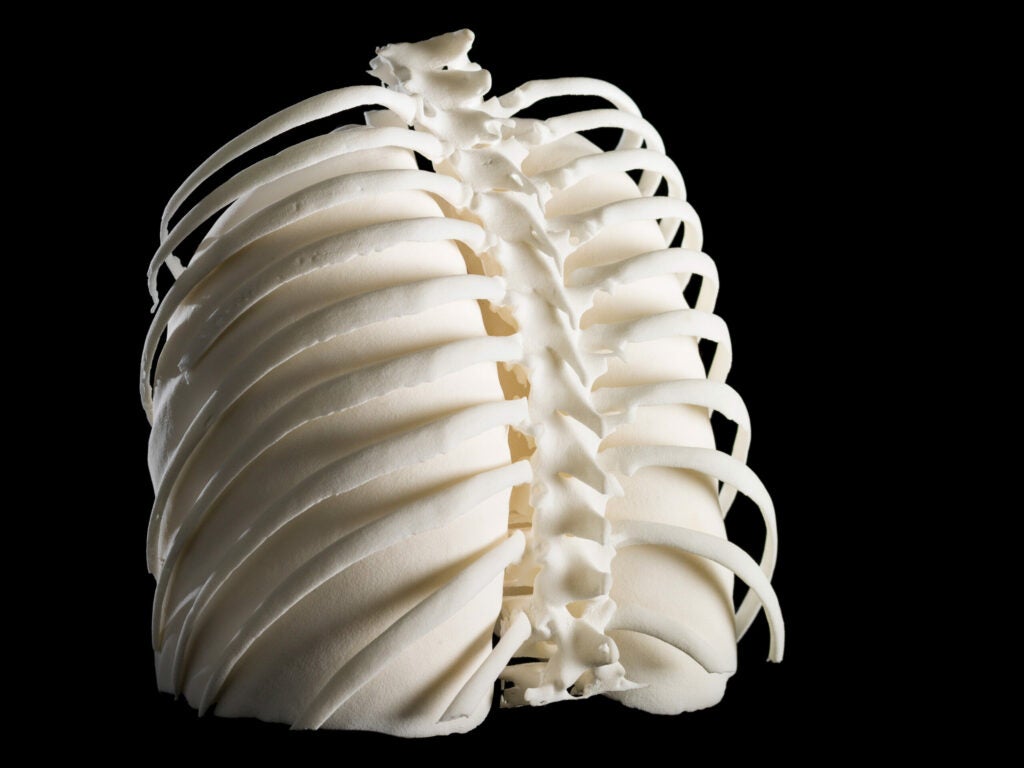 httpswww.popsci.comsitespopsci.comfilesimages2015033d-printed-lungs-in-rib-cage.jpg