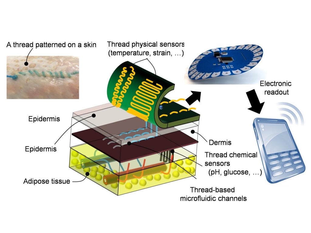 Diagram showing how smart threads could be embedded in skin.