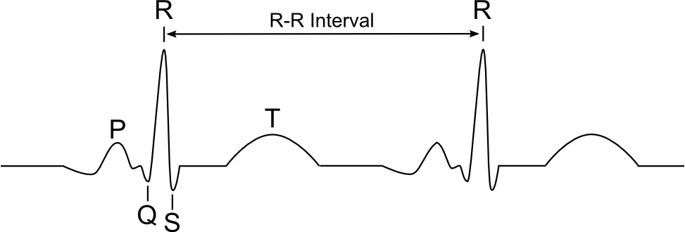 ekg r-r interval