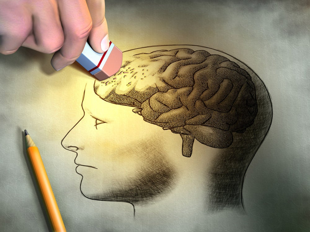 brain erase illustration