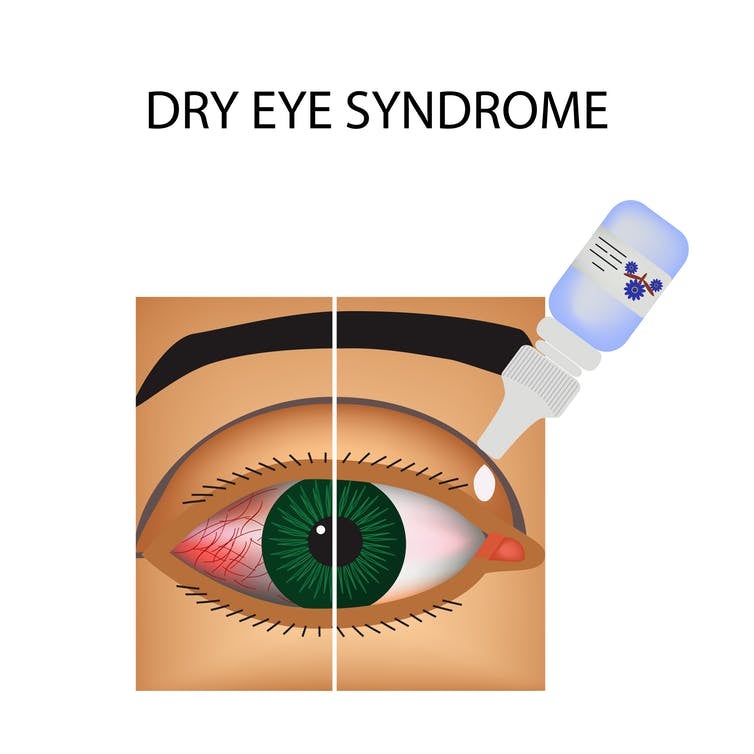 dry eye disease treatment
