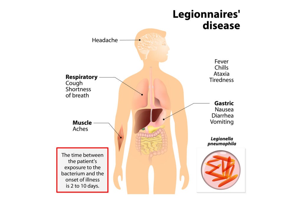Symptoms of Legionnaires’ disease chart