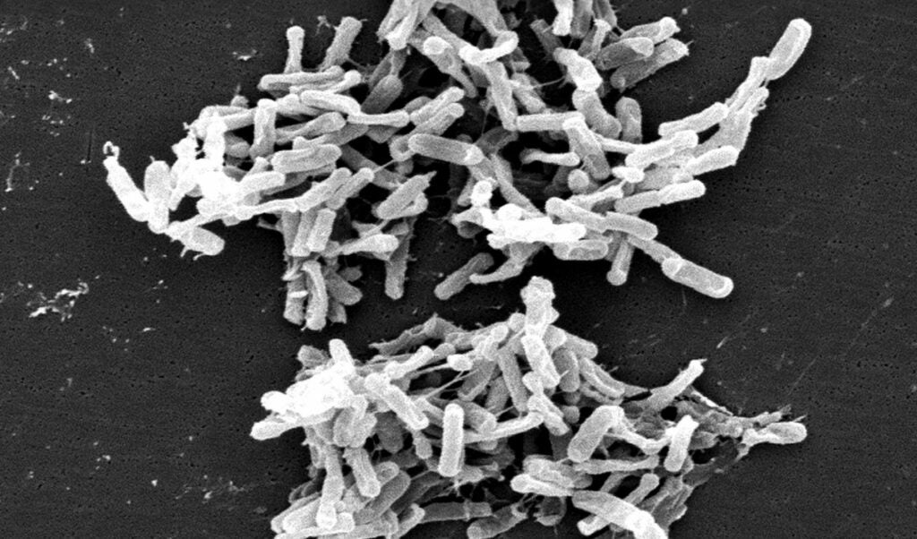 Clostridioides difficile bacteria
