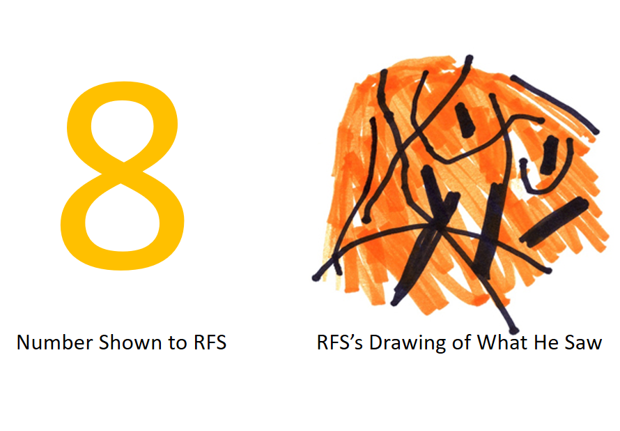 A diagram of what patient RFS sees when shown the number 8.